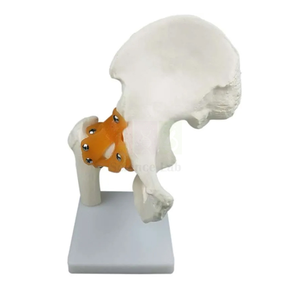 Hip Joint Model
